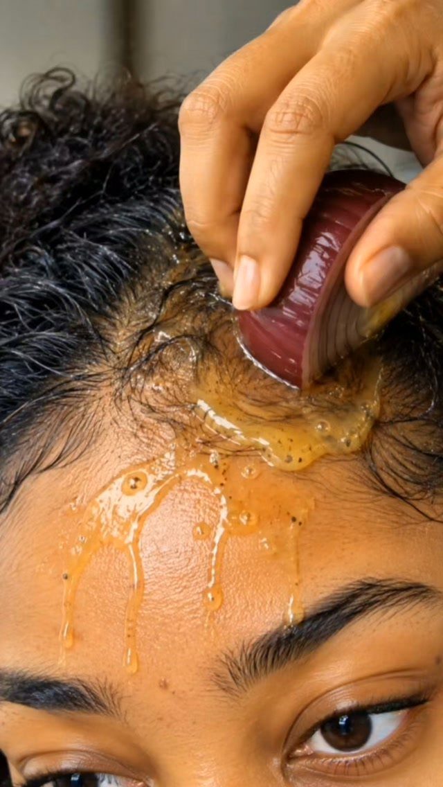 Red onion slice being rubbed onto a scalp with liquid dripping down forehead.